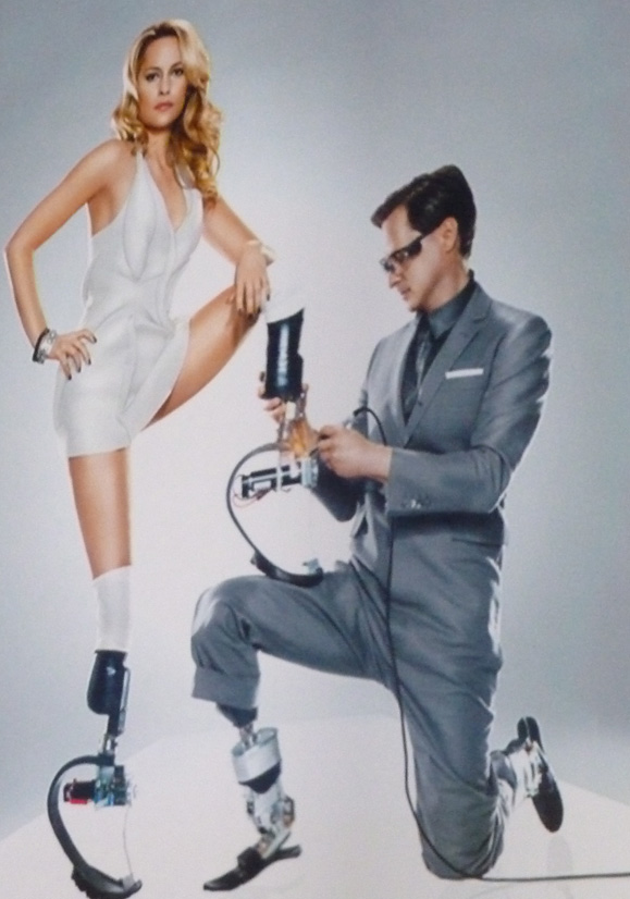 Hugh Herr e a modelo e atriz Aimee na foto em que aparecem na capa da revista War